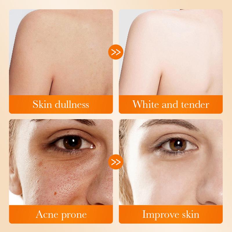 Savon facial à l'acide kojique - Kojic Acid Soap avis et prix